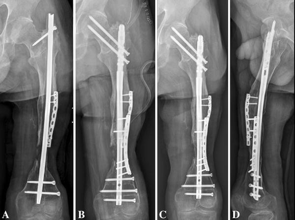 Dr. Sinukumar Bhaskaran – Orthopedic Trauma Specialist in Pune